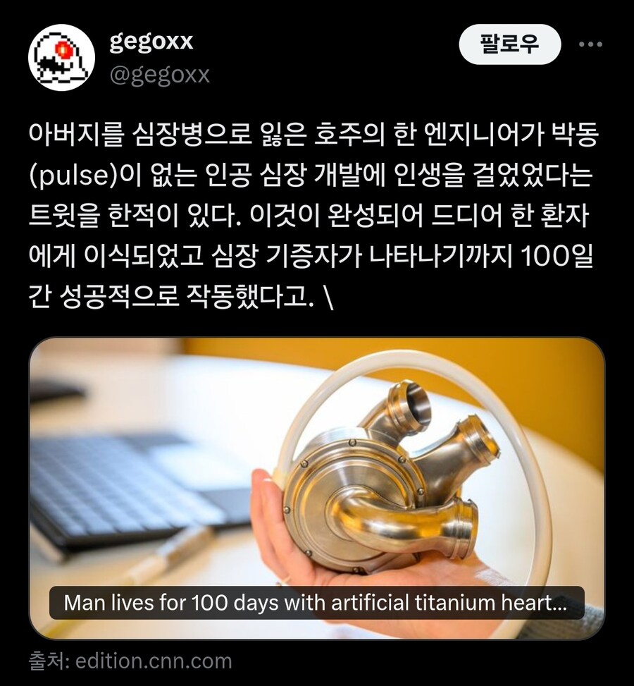 심장병으로 아버지를 잃은 엔지니어가 만든 박동 없는 티타늄 심장_1.jpg