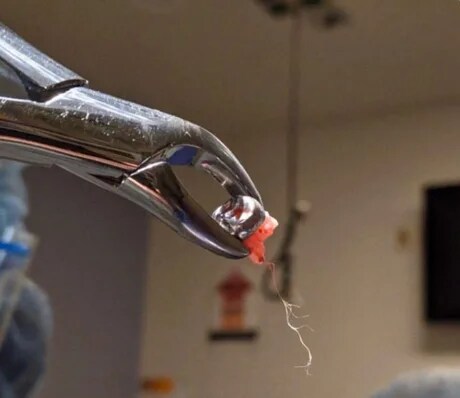 혐짤)치통이 있을때 머리까지 같이 아픈 이유_1.png