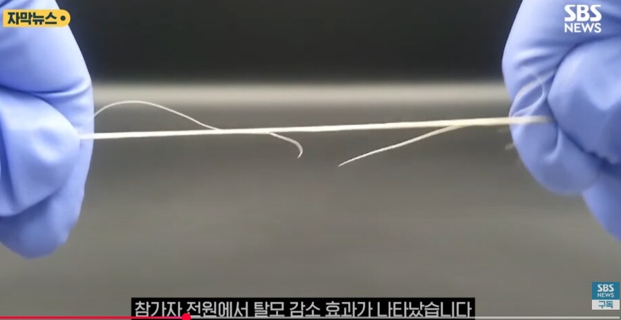 홍합 껍데기로 탈모 예방.jpg_9.jpg