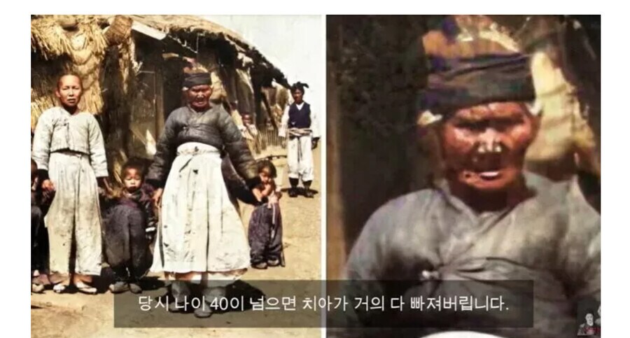 조선시대 40대 여자는 개소리라고 한표 던진다_1.png