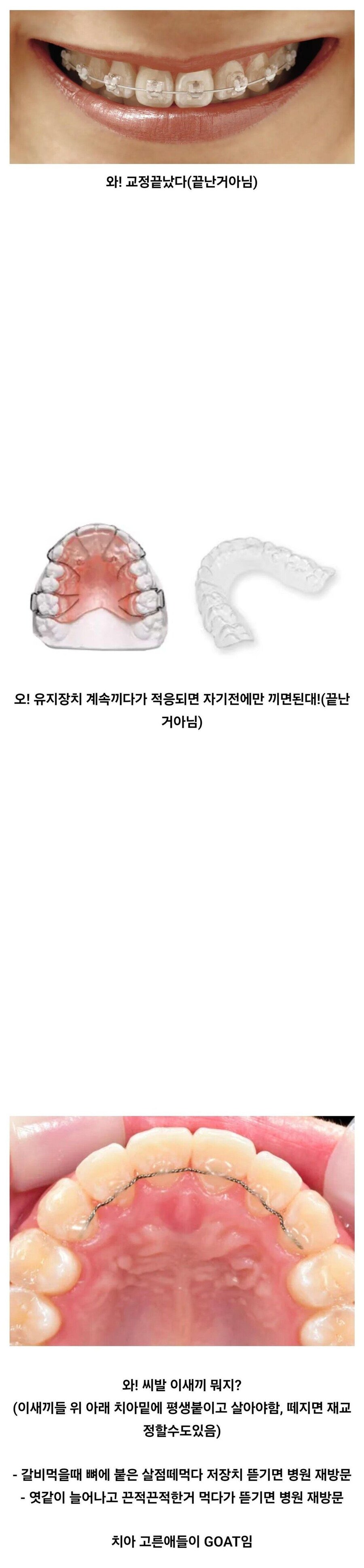 대부분 모르는 치아 교정인들의 삶.jpg_1.jpg