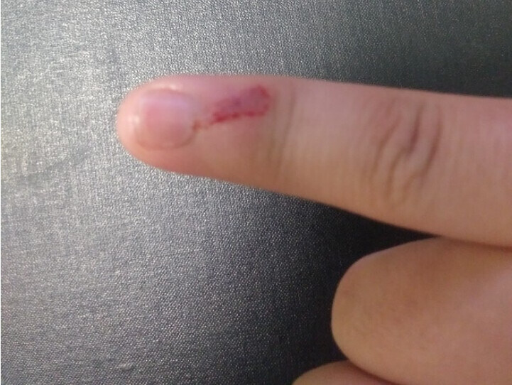 혐 ) 전설의 천하장사 소세지 벗겨 먹는 짤 ㄹㅇ ㅋㅋ_2.jpg