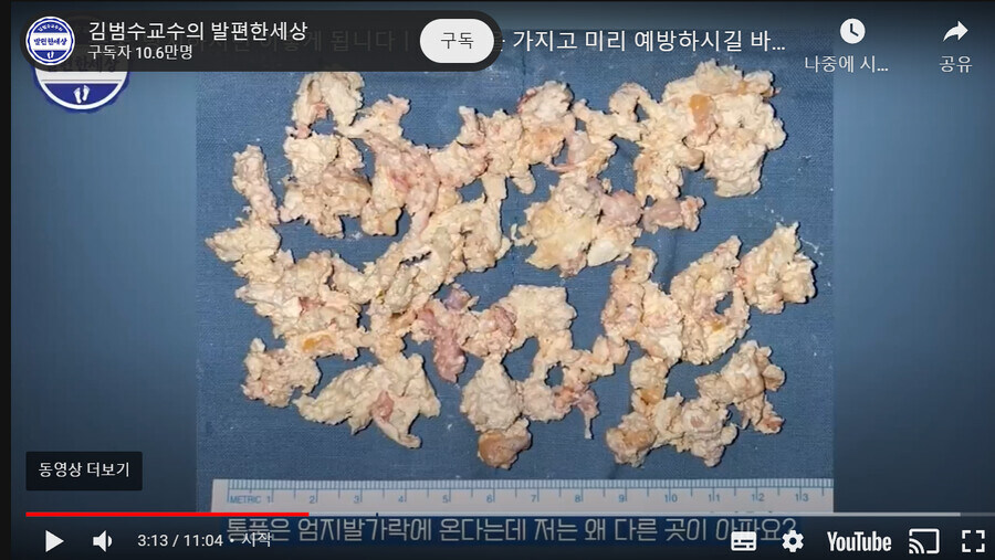 통풍 짤 종합 세트_3.jpg