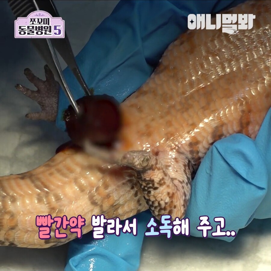 거시기에 플러그가 박혀 내원한 환자_6.jpg