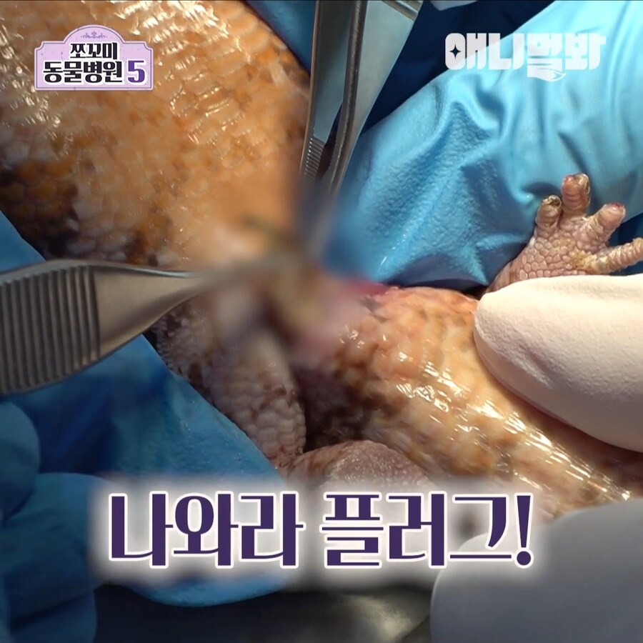 거시기에 플러그가 박혀 내원한 환자_8.jpg