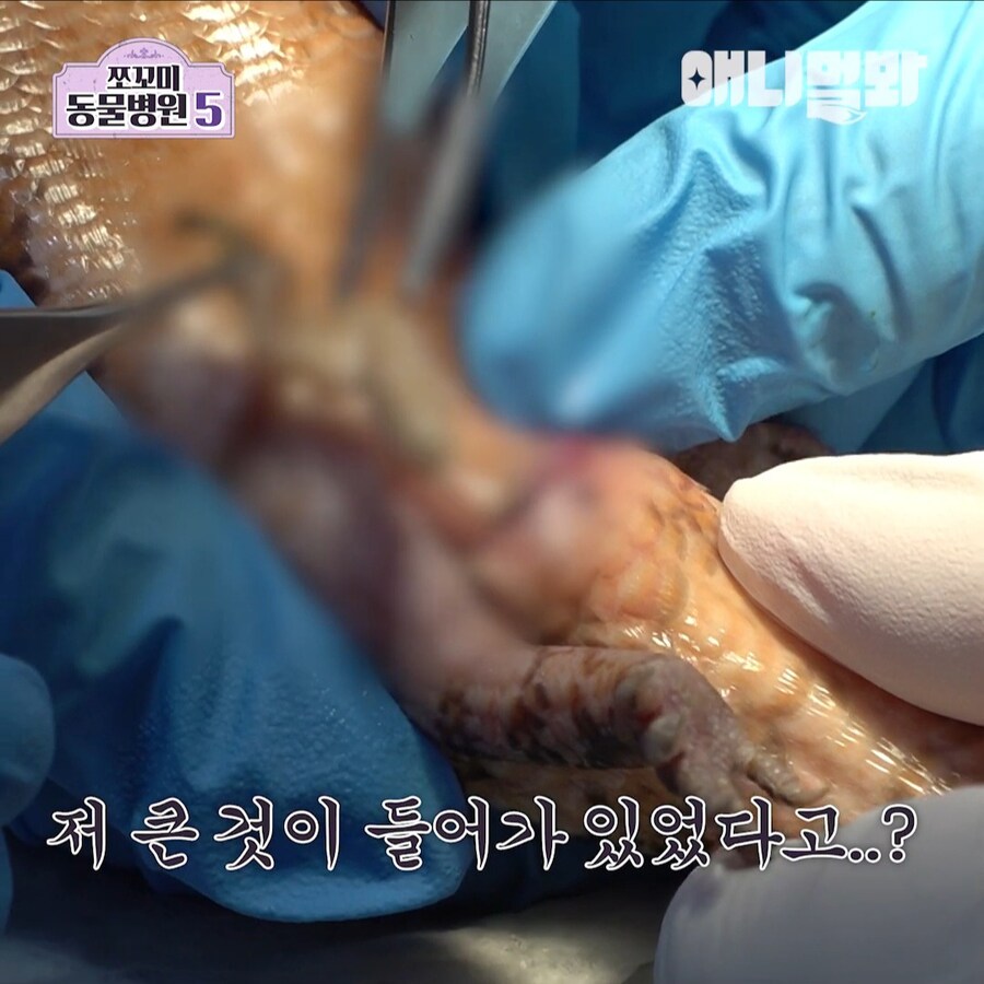 거시기에 플러그가 박혀 내원한 환자_9.jpg