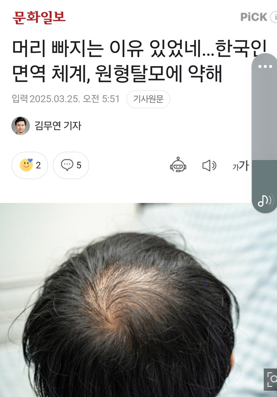 머머리되는 이유 찾아냈다_1.jpg