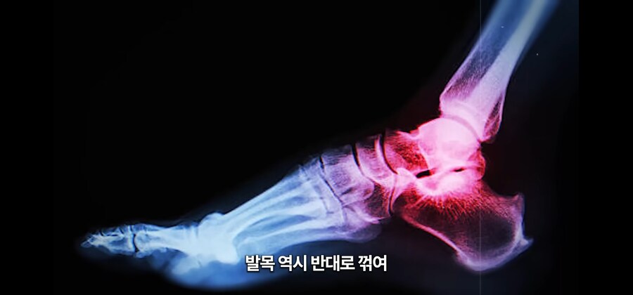 30미터 광산 바닥에 홀로 추락한 노인이 생존한 비결_14.jpg