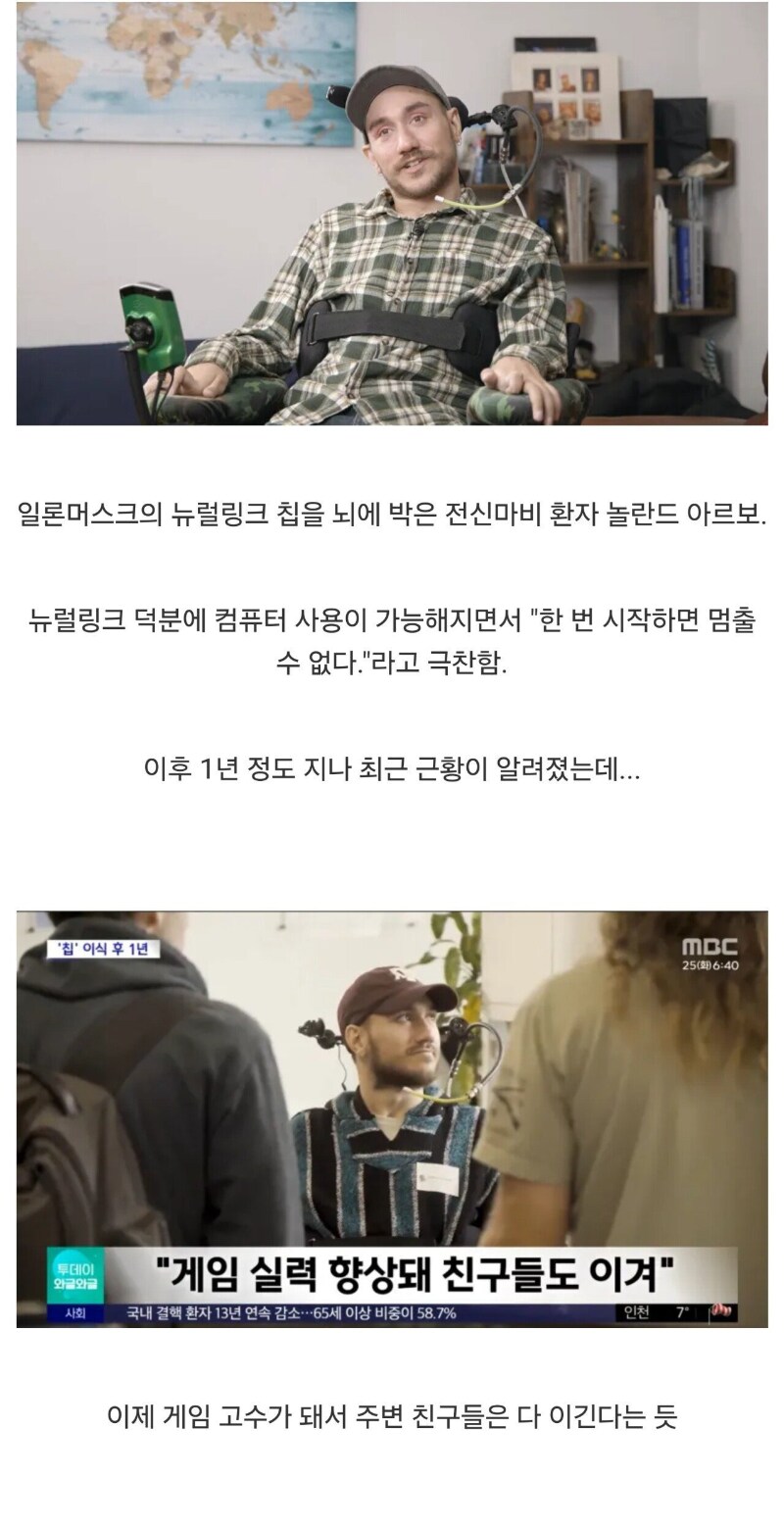 뉴럴링크 시술자, 시술 1년 뒤 현재 근황_1.png