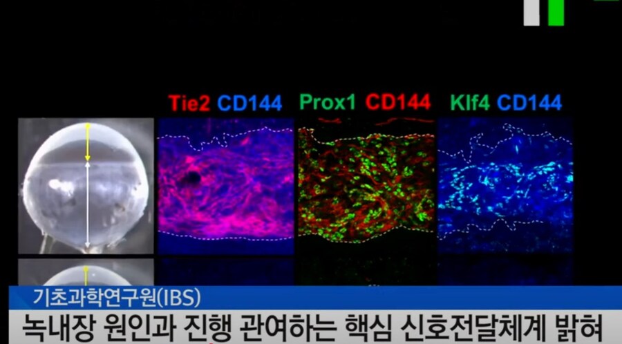 의학 분야의 신기술 개발 뉴스는 걸러들어야 하는 이유_2.jpg