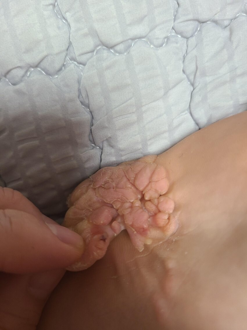 혐)아침부터 사마귀로 눈을 괴롭히다니 보답이다_2.jpg