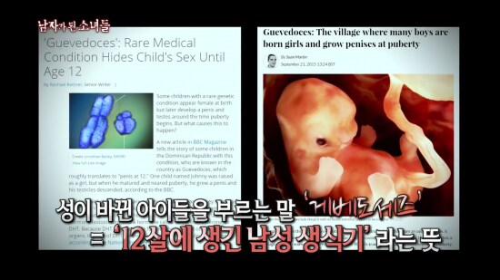 여자 → 남자로 성별이 바뀌는 병 '게베도세즈'_3.png