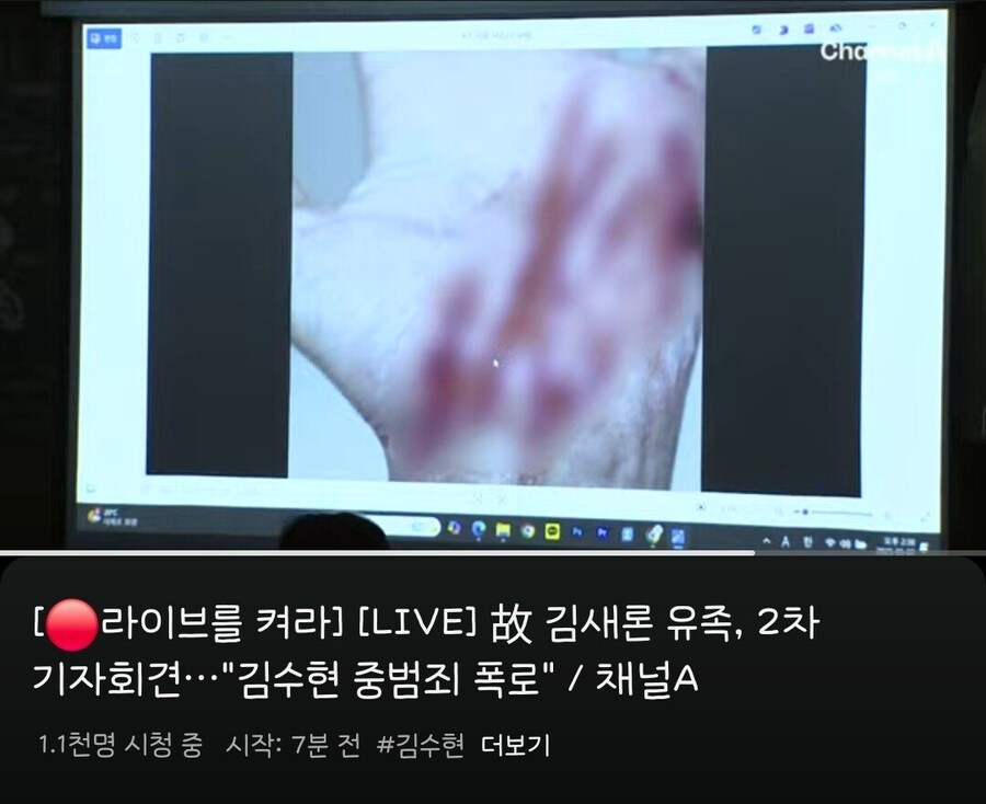 가세연 제보자 피습당한 사진 공개.jpg_1.jpg