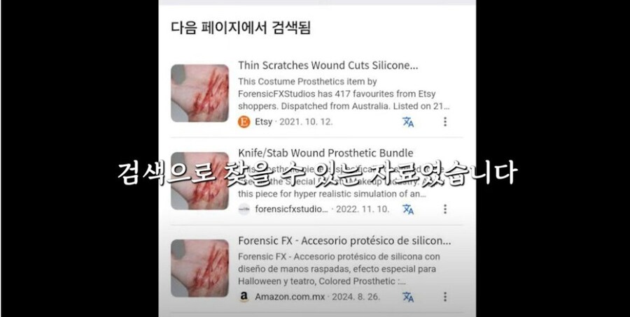 가세연 제보자 피습당한 사진 공개.jpg_3.jpg