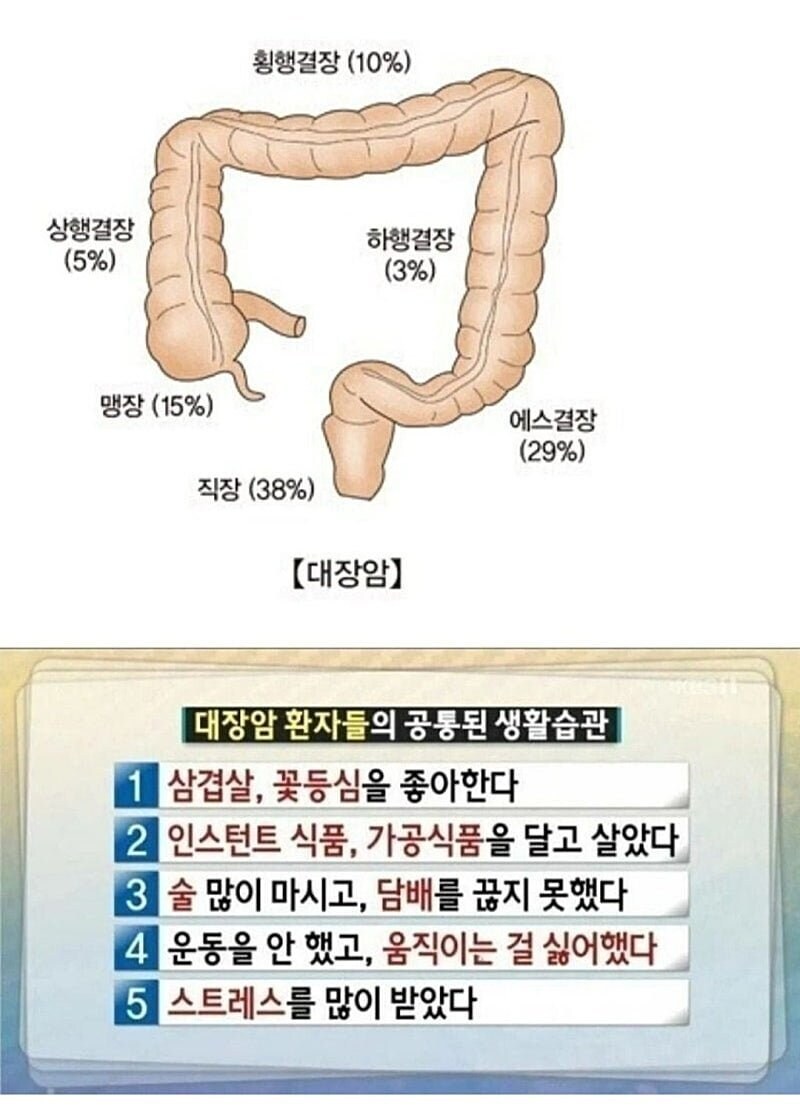 대장암 환자들의 공통점.jpg_1.jpg