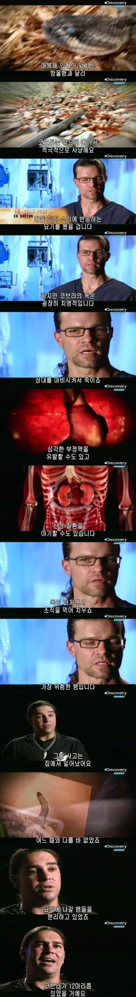 [극혐] 코브라한테 물려서 몸에 구멍이 생긴 남자.jpg_1.jpg