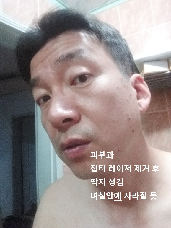 0522 운동일지: "레이저 대공세" 편_20.jpg