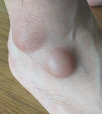 뮌헨) 김민재 추가부상 발생함_1.png