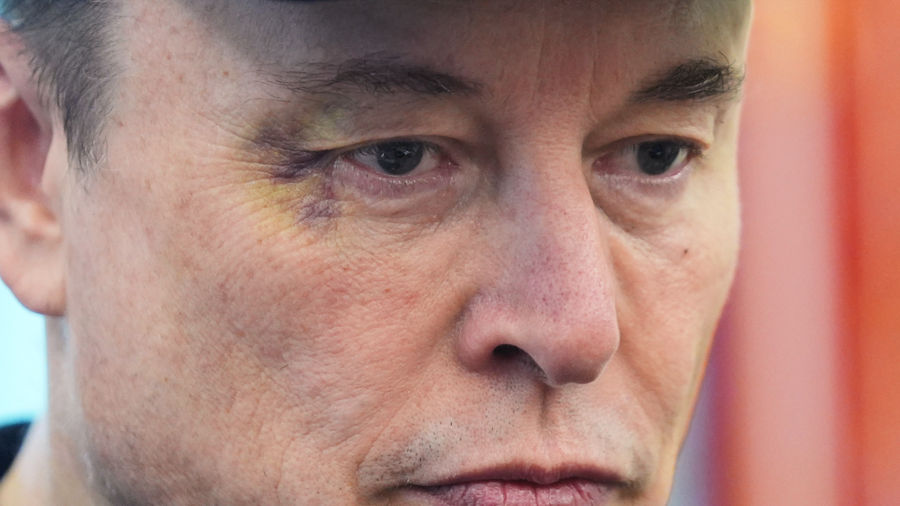 머스크 눈에 멍든 (진짜) 이유..jpg_3.webp