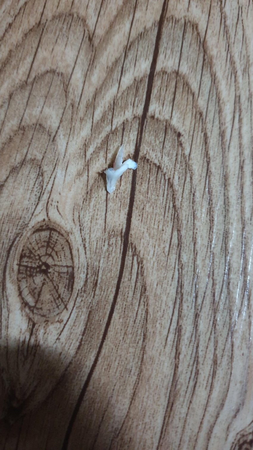 혐) 내성발톱 모음집_6.jpg