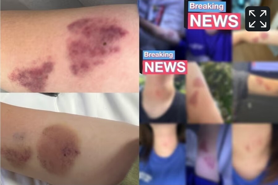 얼마전에 sm과잉 경호 논란이던거 피해자 기사 떳네_1.jpg