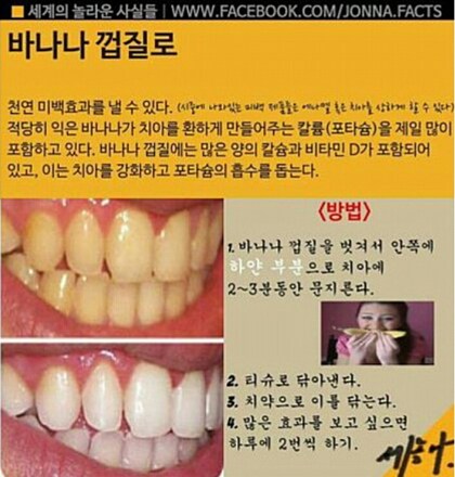 바나나껍질 치아미백효과_1.png