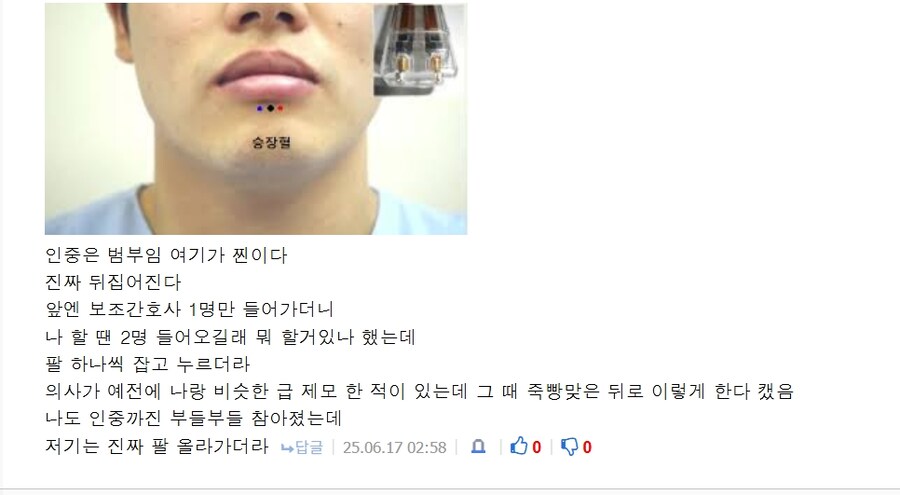 꼬추털 뽑는거보다 더 아프다는 부위_2.jpg