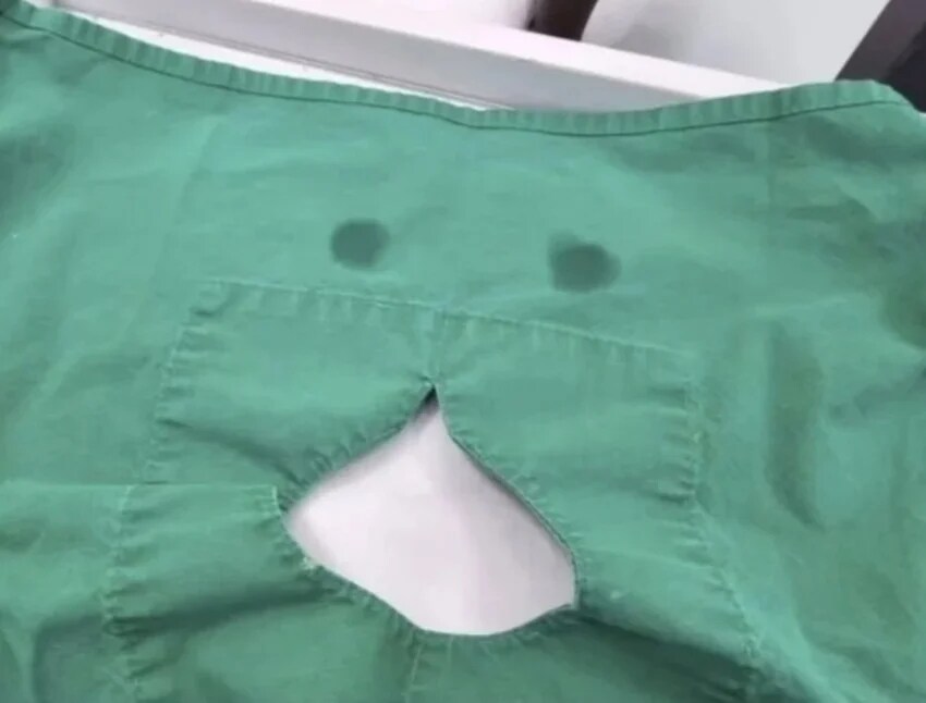 사랑니 발치가 안무서운 환자 사진_1.png