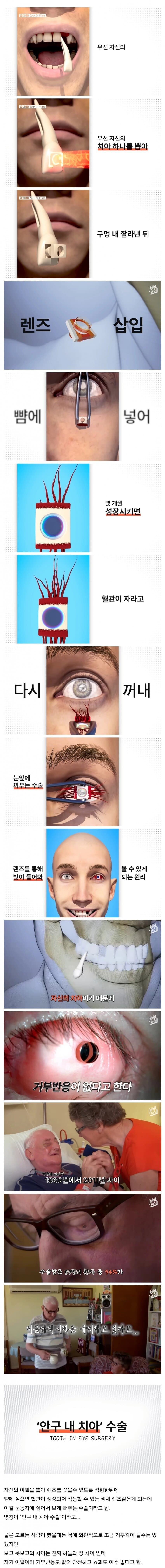 현대 의학 근황_1.png