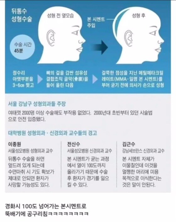 갈때까지 가버린 한국 성형 근황.jpg_1.jpg