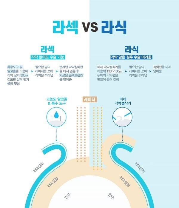 부작용 있다 없다로 30년째 논란인 수술_3.jpg