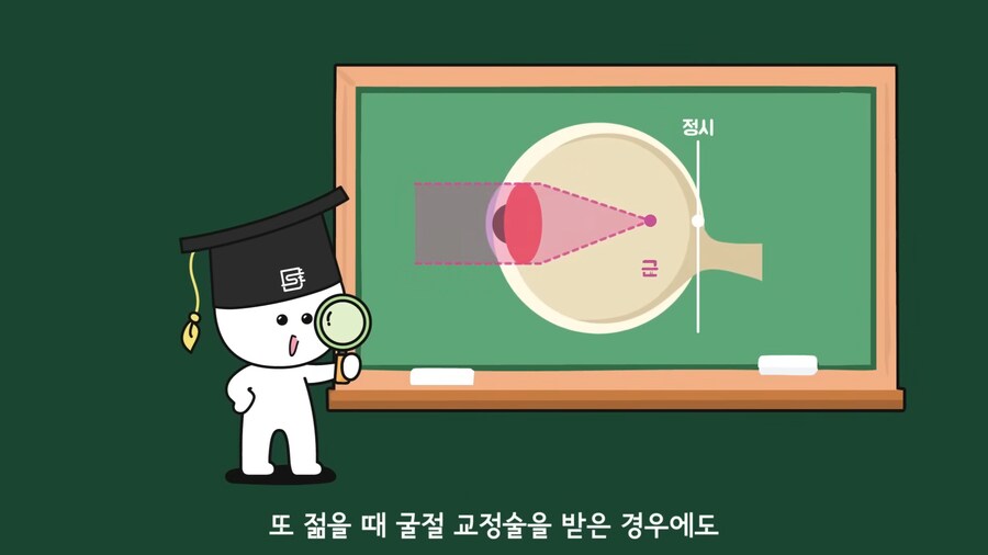 안과 의사들이 안경을 쓰는 이유.jpg_20.png