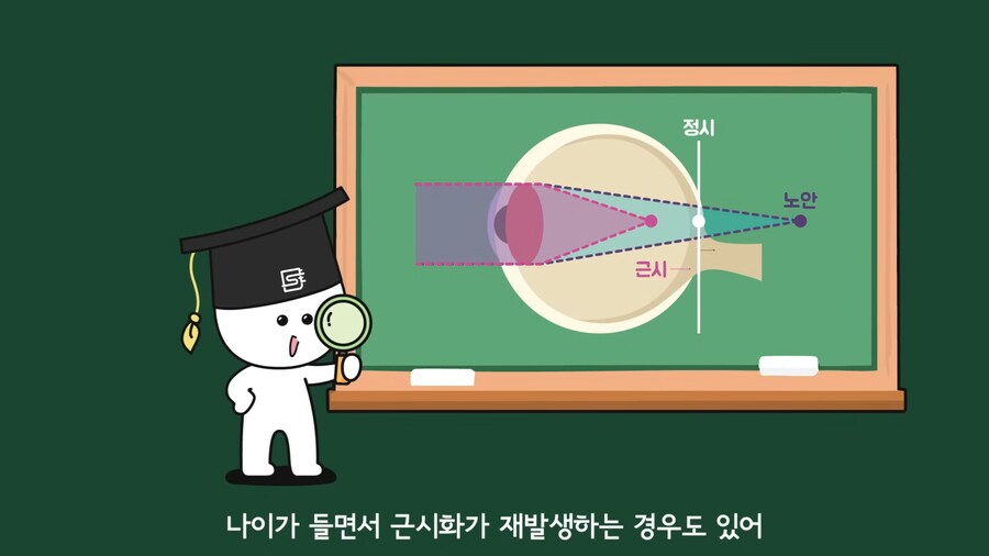 안과 의사들이 안경을 쓰는 이유.jpg_21.png