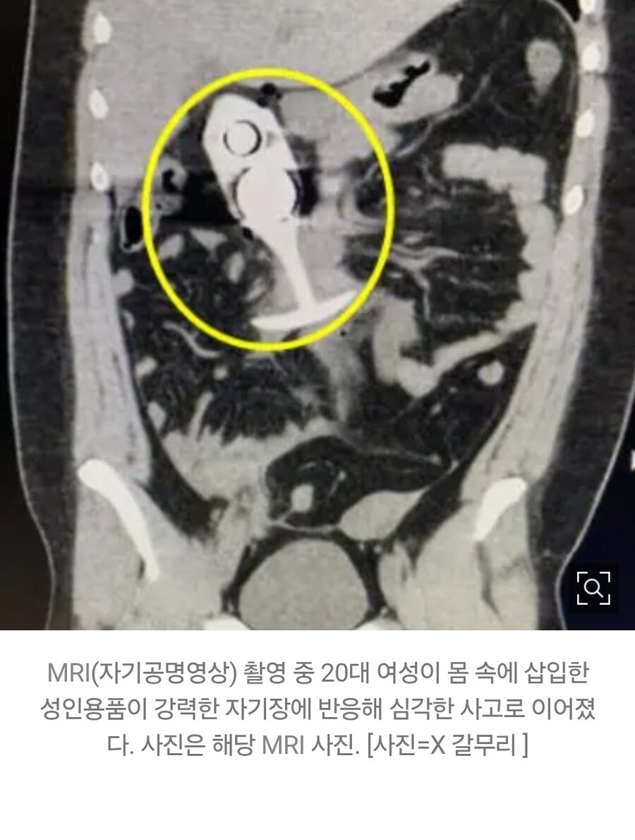 항문은 입구가 아님을 다시 깨달아야하는 기사_2.jpg