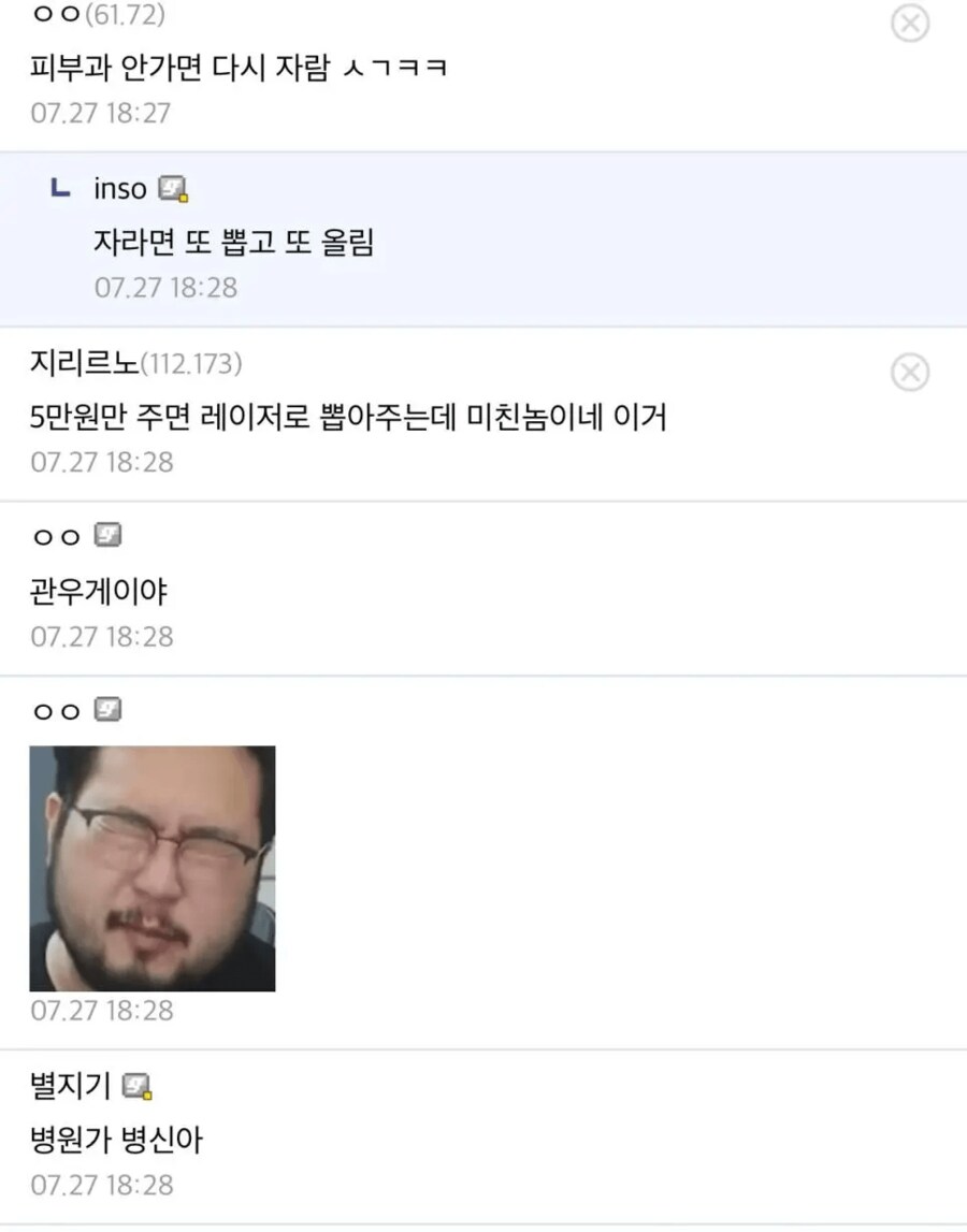 혐) 손에 자란 사마귀 뽑음_3.png
