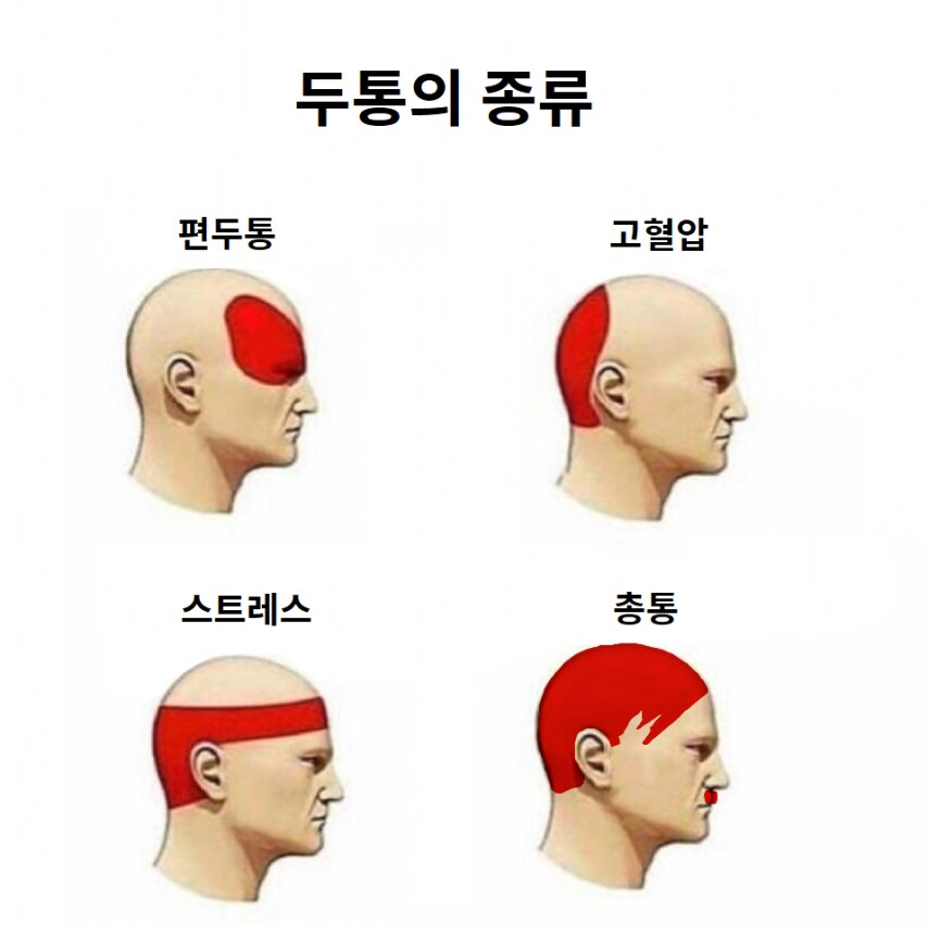 두통의 종류_1.png