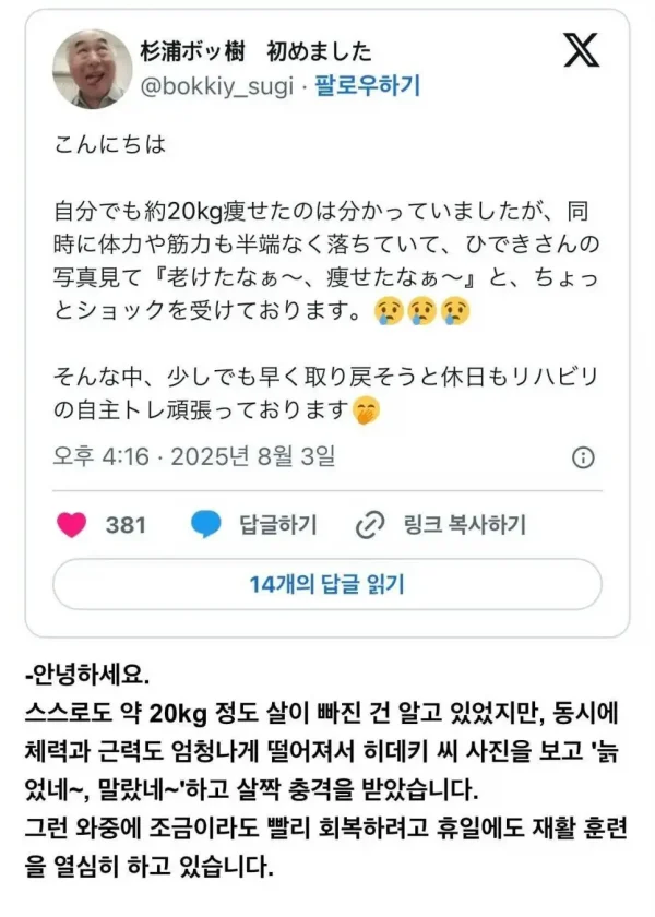 희귀병에 걸린 AV배우.jpg_4.webp