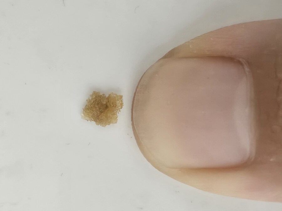 약혐)물을 많이 마셔야 하는 이유_3.jpg