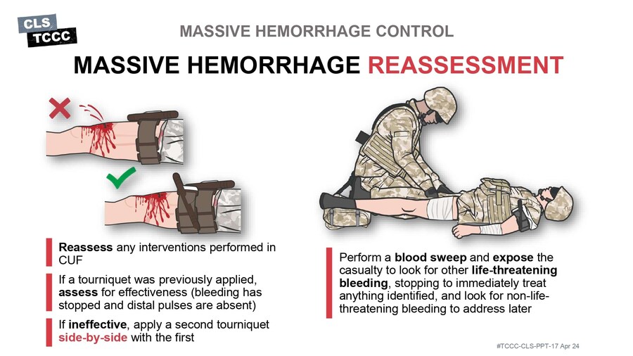 혐?) 피를 멈추는 방법_4.jpg