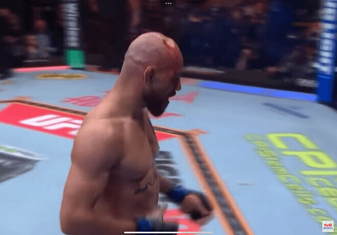 오늘 UFC경기의 엄청 무서운 장면 (혐)_2.jpg