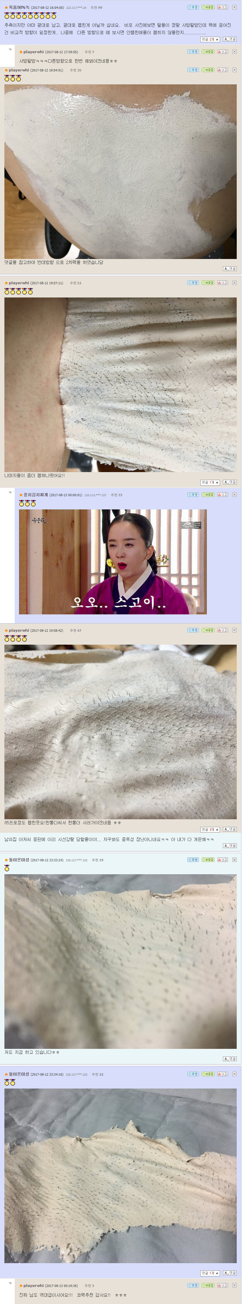 등 잔털 제거 후기.jpg_8.jpg