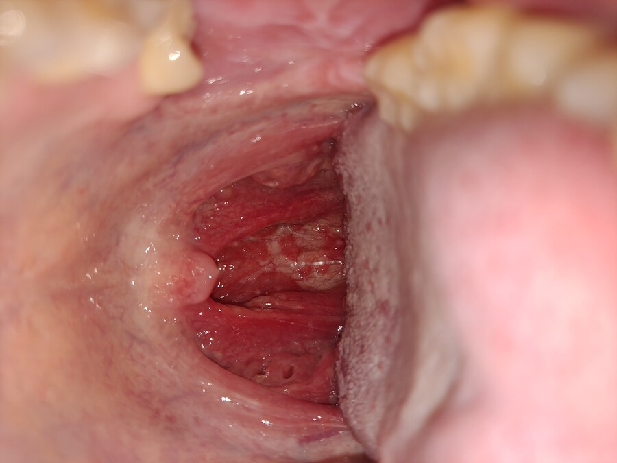 혐) 코로나 걸림_1.jpg