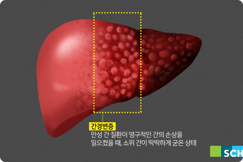 물복 딱복보다 호불호 갈리는거_1.png