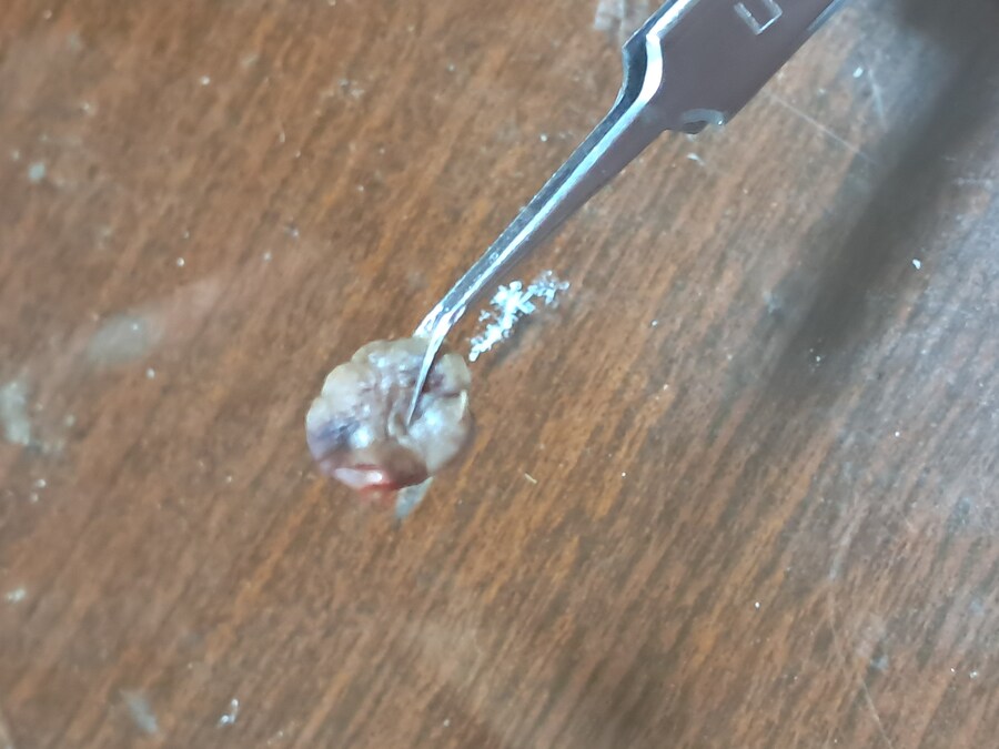 혐) 야심한 새벽에 쥐젖 잘랐다_2.jpg