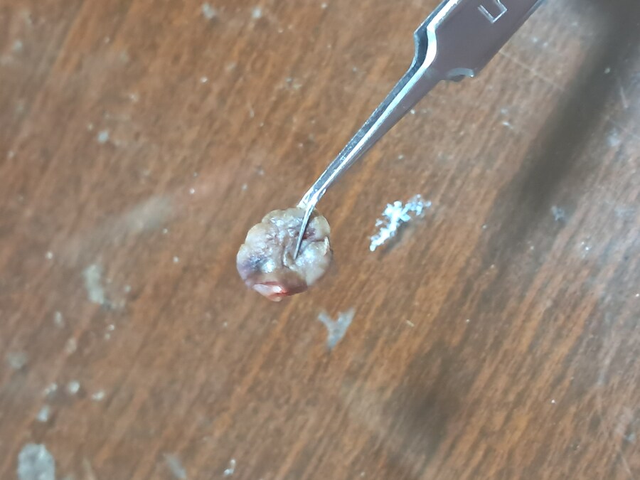 혐) 야심한 새벽에 쥐젖 잘랐다_3.jpg