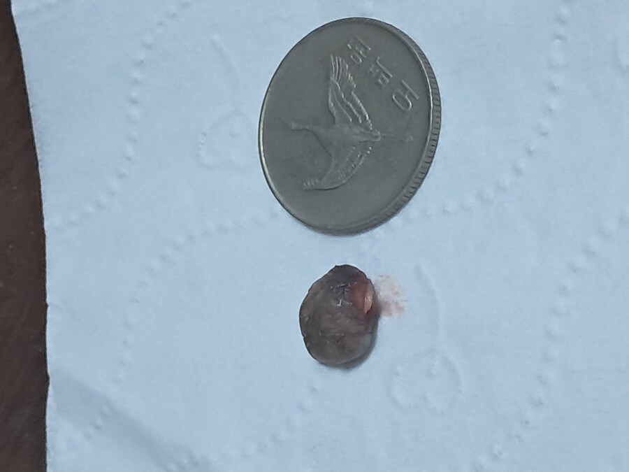 혐) 야심한 새벽에 쥐젖 잘랐다_5.jpg