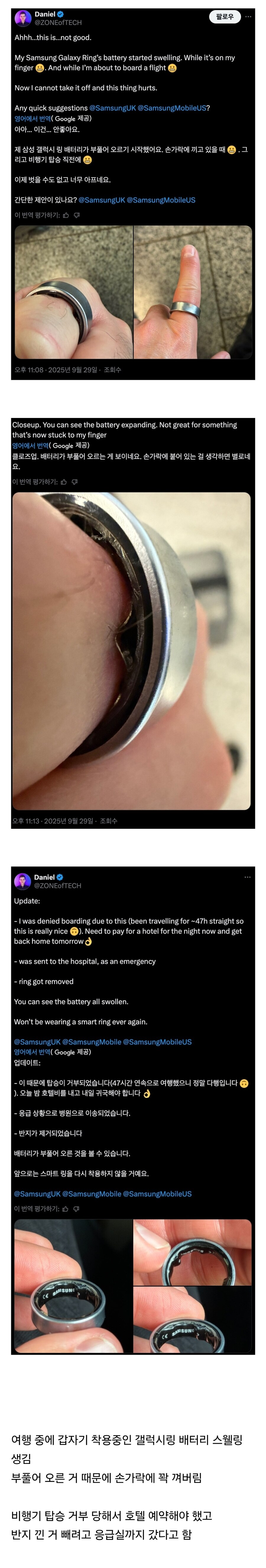 여행 중에 갤럭시링 배터리가 부풀었다는 외국인_1.jpg