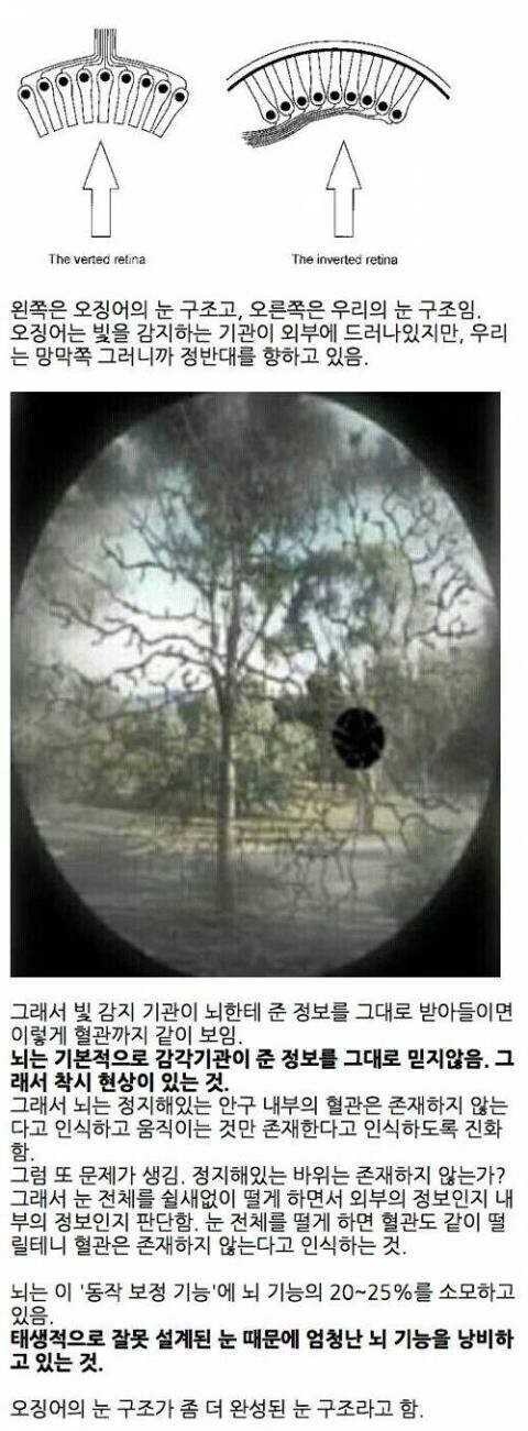 우리 몸의 ㅂㅅ같이 설계된 부분들.jpg_3.jpg