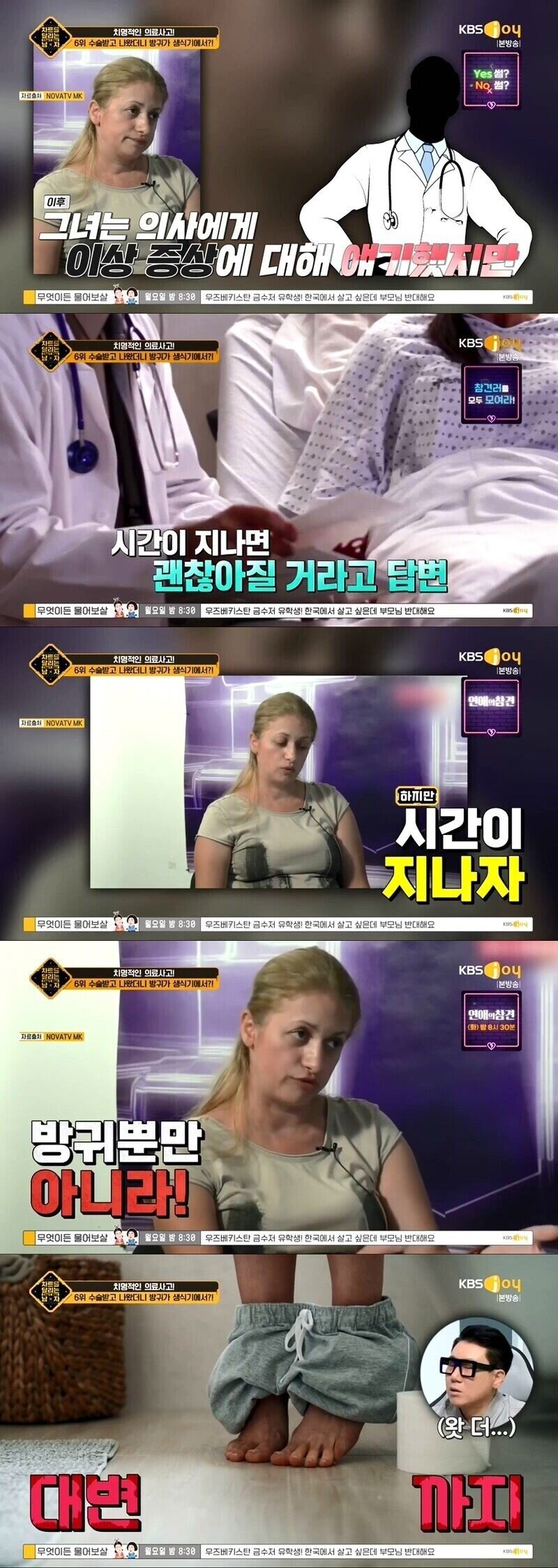 대장암 수술했더니 방귀가 다른곳에서 나온 여자_2.jpg
