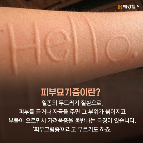 본인이 걸린 질병으로 예술하는 사람_2.jpg